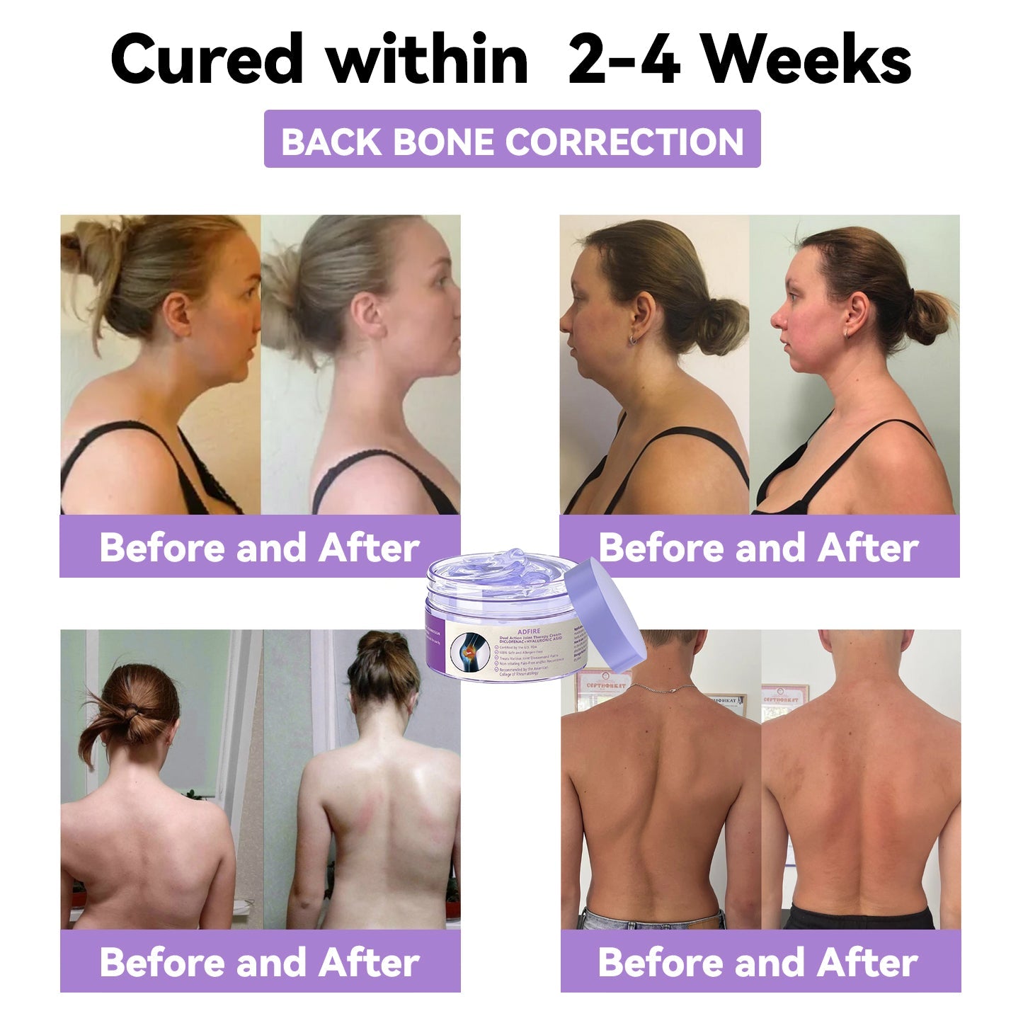 ADFIRE® 7 Day Rapid Joint & Bone Therapy Cream USA Orthopedics (AAOS) Approved