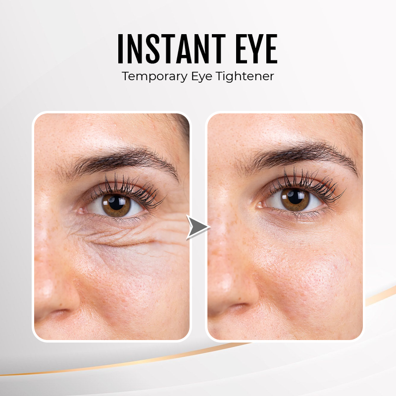 Jorondy® Instant Wrinkle Eye Tightener cream 🔥 Last Day Discount: 80% OFF 🔥