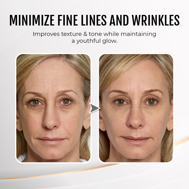 Jorondy® Instant Wrinkle Eye Tightener cream 🔥 Last Day Discount: 80% OFF 🔥