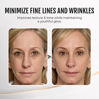 Jorondy® Instant Wrinkle Eye Tightener cream 🔥 Last Day Discount: 80% OFF 🔥