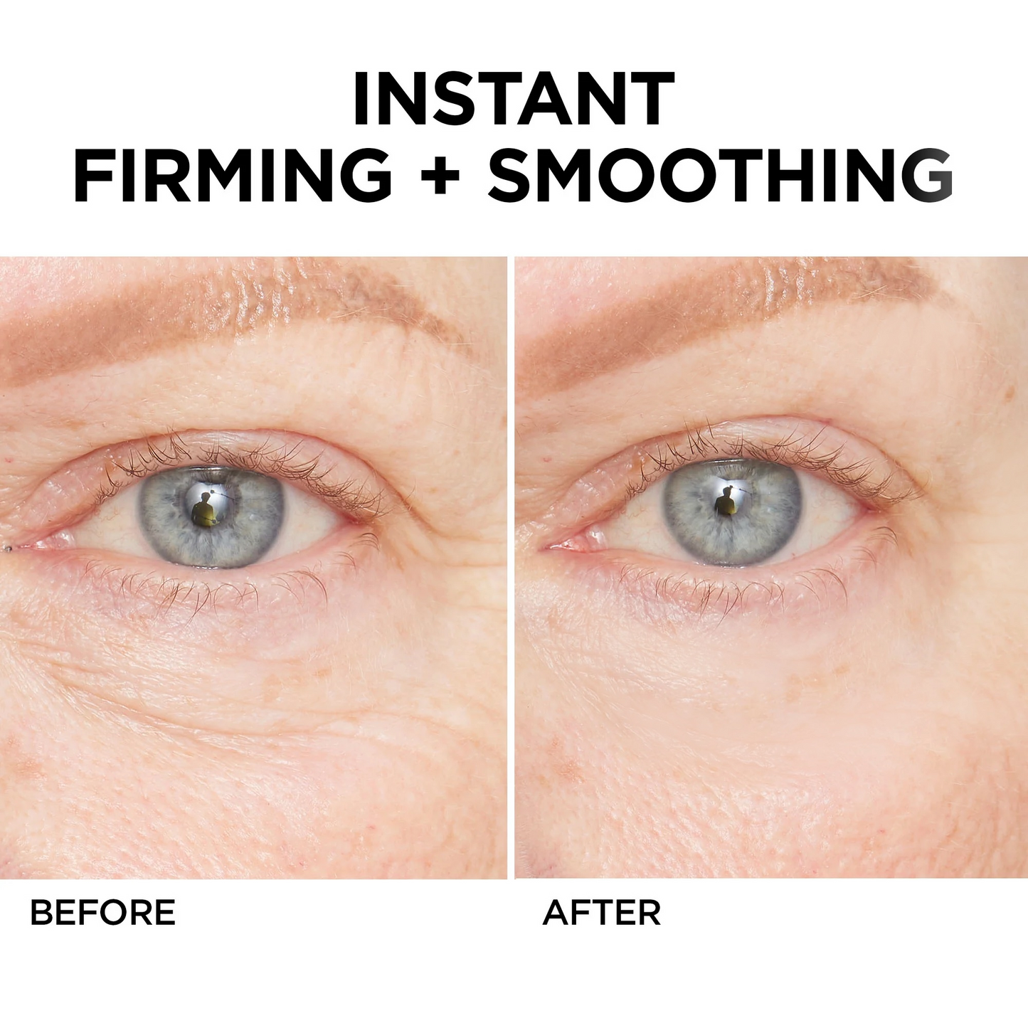Jorondy® Instant Wrinkle Eye Tightener cream 🔥 Last Day Discount: 80% OFF 🔥