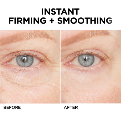 Jorondy® Instant Wrinkle Eye Tightener cream 🔥 Last Day Discount: 80% OFF 🔥