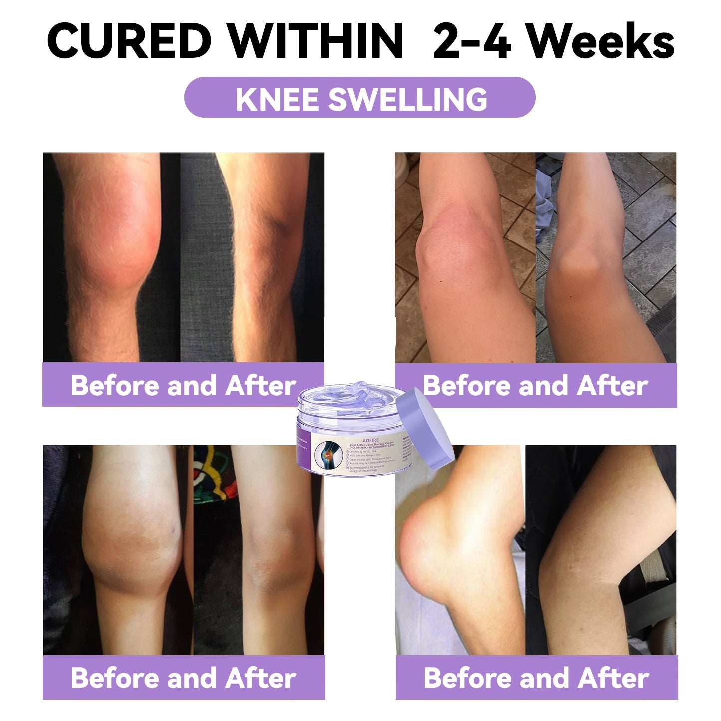 ADFIRE® 7 Day Rapid Joint & Bone Therapy Cream USA Orthopedics (AAOS) Approved