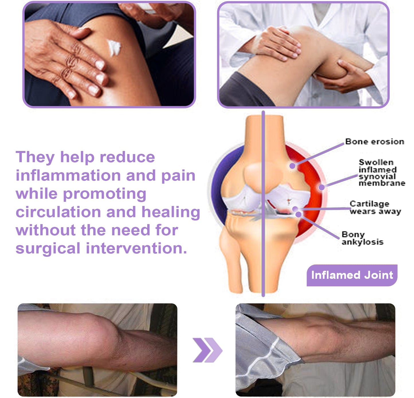 ADFIRE® 7 Day Rapid Joint & Bone Therapy Cream USA Orthopedics (AAOS) Approved