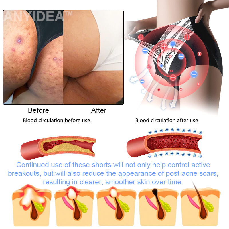 Titanium Fiber Self-heating Tourmaline Shaping Shorts💙Recommended by Australian Medical Association